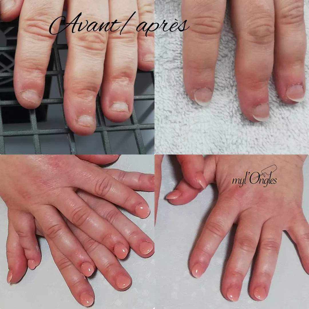 Pose gel sur chablons ou capsules américaines pour rallongement ongles rongés