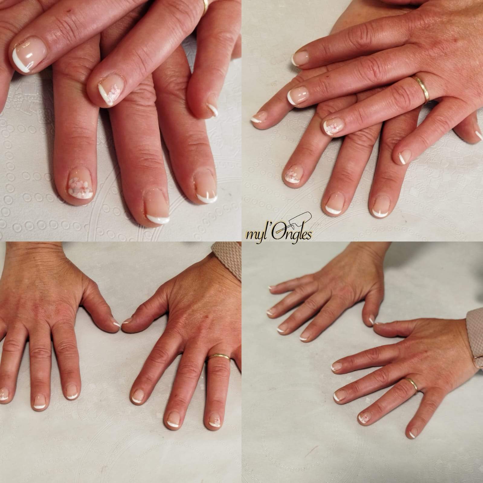 VSP renforcé avec french sur ongles courts et fleurs en foils