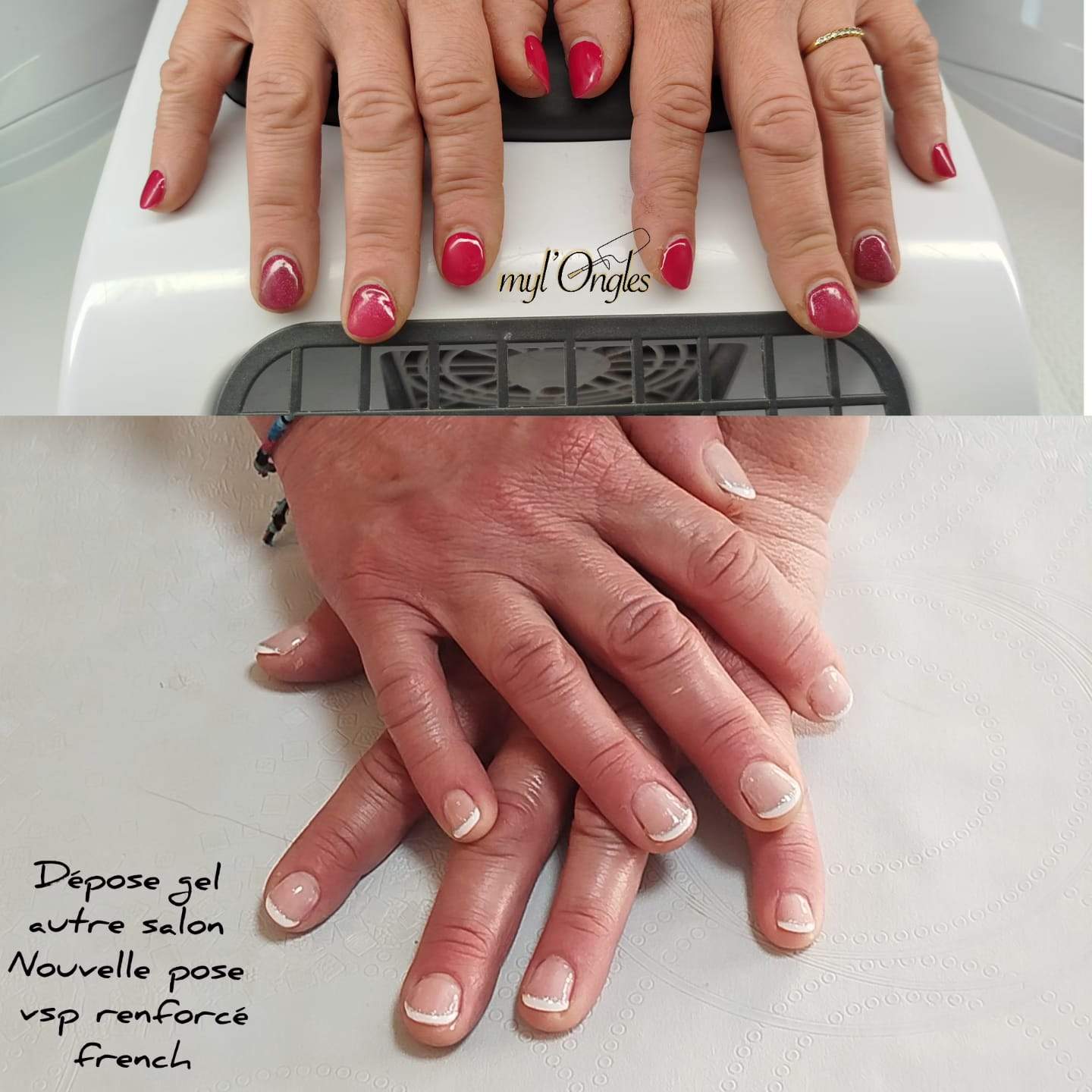 Dépose ongles et pose de VSP renforcé avec french manucure sur ongles courts