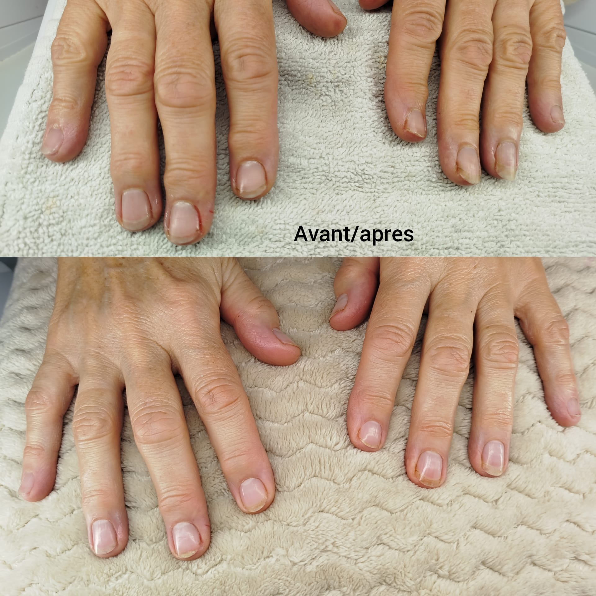 Manucure soin japonais à la kératine pour corriger les ongles striés