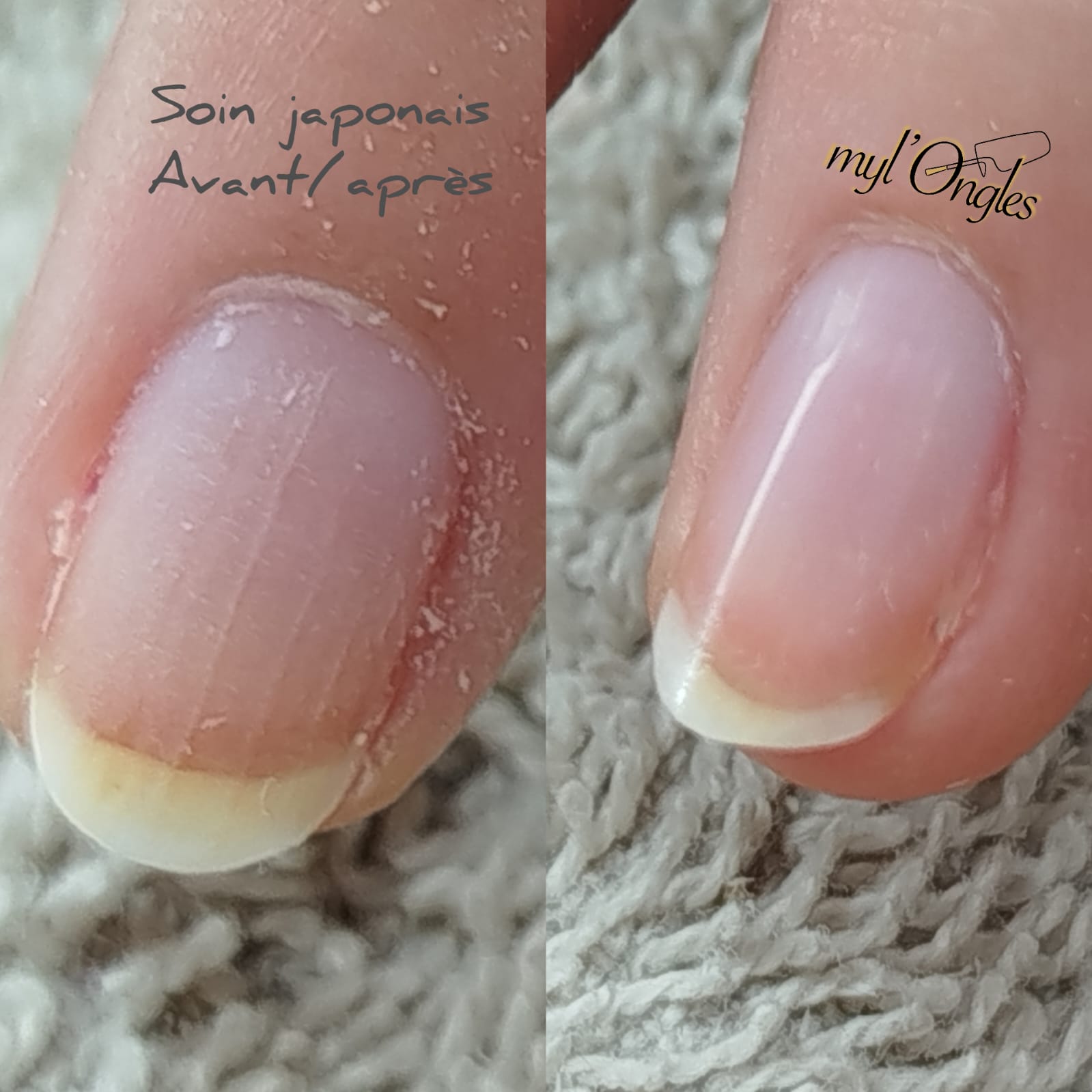 Détail de la manucure avec soin japonais pour corriger les ongles striés